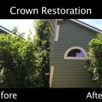 Crown Restoration - Before & After